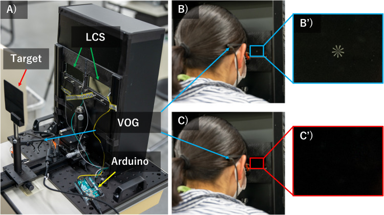 Objective Evaluation of Relationship Between Tear Film Stability and Visual Fatigue.
