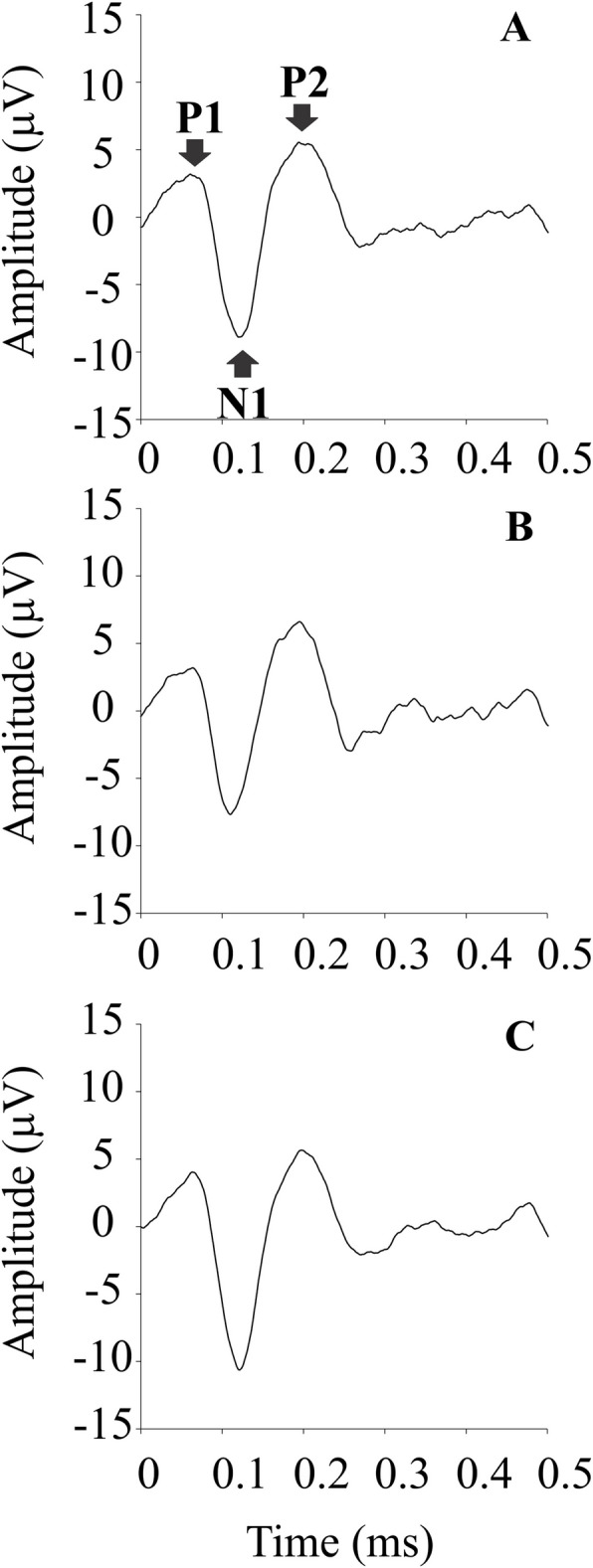 Luminance noise impacts putative luminance components of visual evoked potentials but not chromatic components.