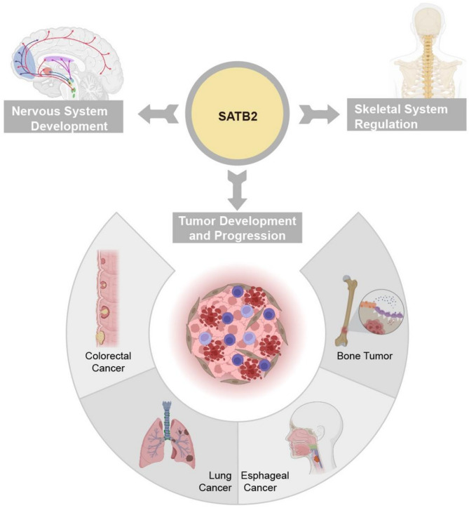 Advances in research on SATB2 and its role in tumor development.