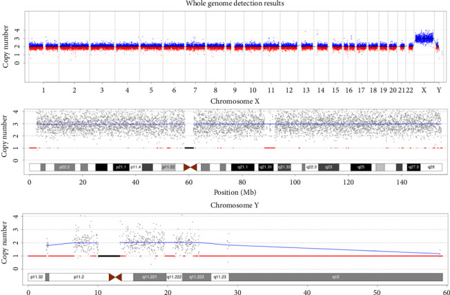 49, XXXYY: Parental Origin, Occurrence, and Clinical Phenotypes.