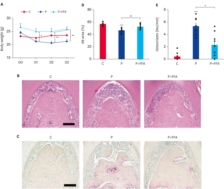 Flufenamic acid reduces alveolar bone loss and pyrazole 3 enhances alveolar bone recovery in periodontitis mice.