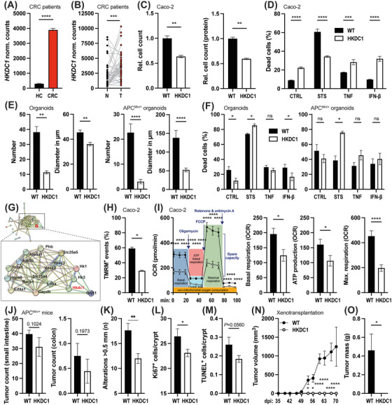 Deletion of epithelial HKDC1 decelerates cellular proliferation and impairs mitochondrial function of tumorous epithelial cells thereby protecting from intestinal carcinogenesis.