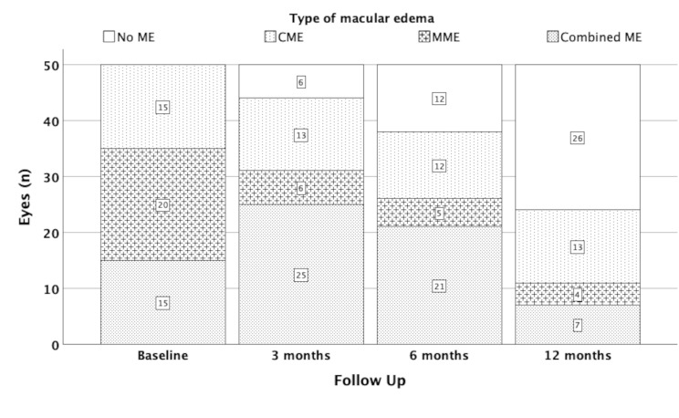 The impact of epiretinal membrane stage and postoperative treatment on visual and anatomical outcomes following vitrectomy in eyes with preexisting macular edema.