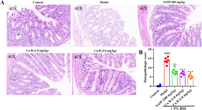 Cucurbitacin B alleviates DSS-induced ulcerative colitis by improving gut microbiota disorder in C57BL/6 mice.