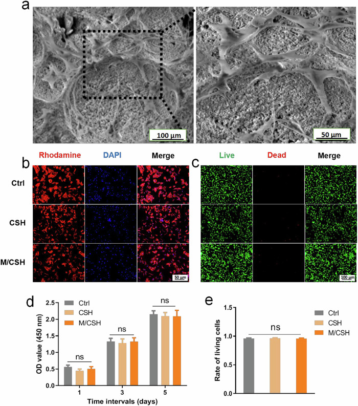 An injectable calcium sulfate-monetite biphasic cement for the treatment of critical-sized calvarial defects