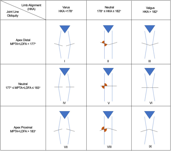 Restricted kinematic total knee arthroplasty provided better functional outcomes and higher satisfaction rates for Asians of genu varum with apex distal joint line over unrestricted kinematic total knee arthroplasty.