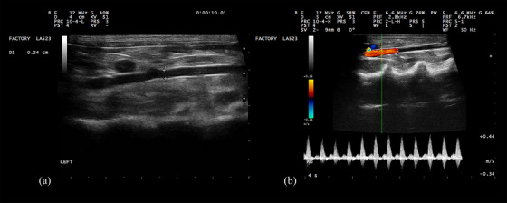 Ultrasonographic Measurement of the Renal Cortical Thickness-to-Abdominal Aortic Ratio in Healthy Rabbits.