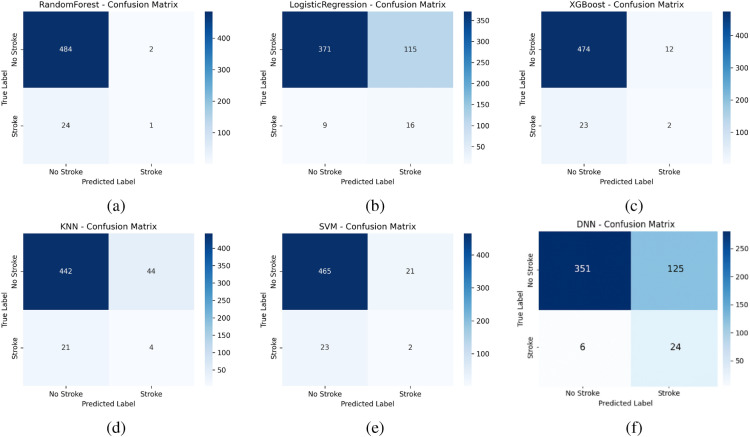 A comprehensive explainable AI approach for enhancing transparency and interpretability in stroke prediction.