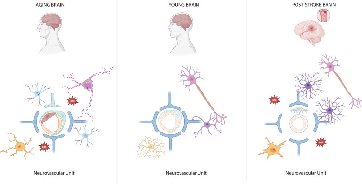 Advances in brain remodeling, stem cell therapies, and translational barriers in stroke and brain aging.