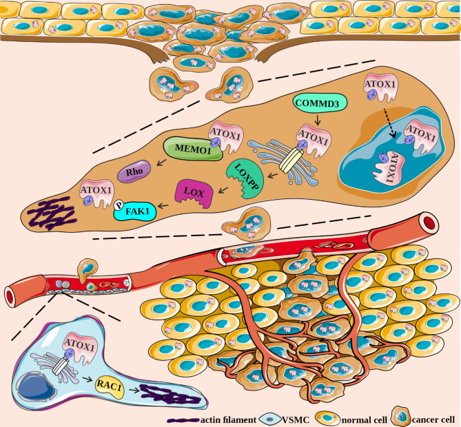 Balancing between cuproplasia and copper-dependent cell death: molecular basis and clinical implications of ATOX1 in cancer.