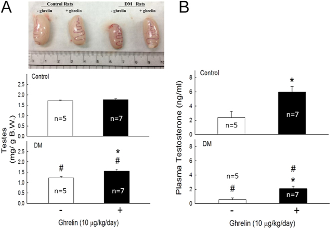 Regulatory mechanism of ghrelin on testosterone secretion in type 1 diabetic rats.