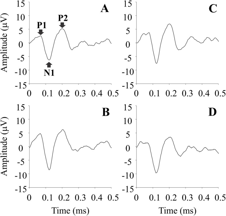 Luminance noise impacts putative luminance components of visual evoked potentials but not chromatic components.