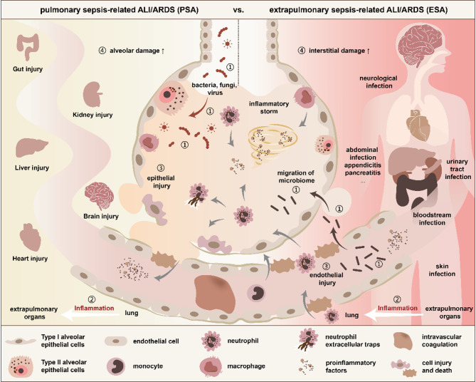 Crosstalk between lung and extrapulmonary organs in sepsis-related acute lung injury/acute respiratory distress syndrome.