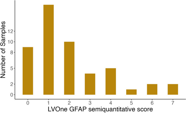 A Technical Assessment of a Commercial GFAP Lateral Flow Assay to Establish Proof-of-Concept for Use in Traumatic Brain Injury.