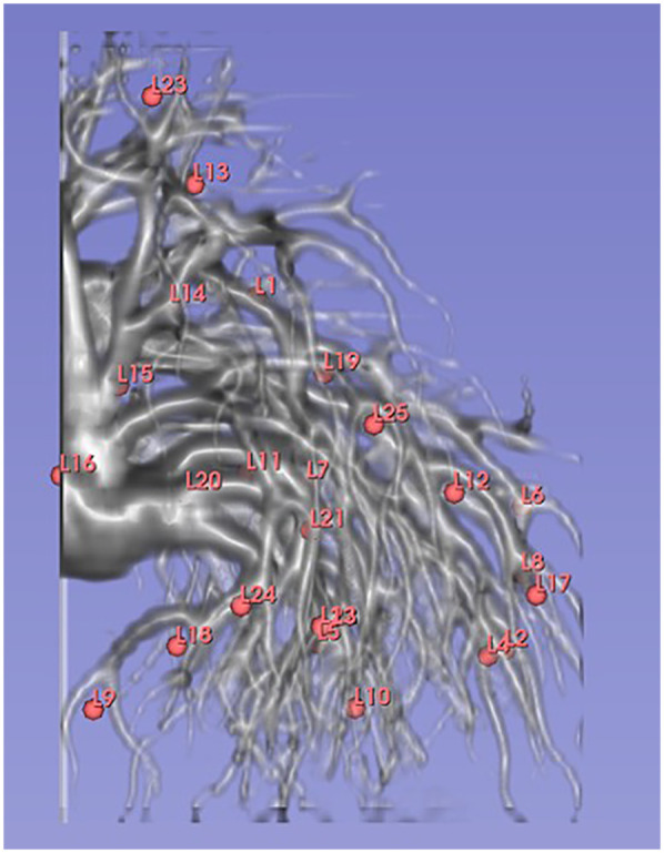 Assessing the consistency of CT-based ventilation imaging under noise reduction processing with simulated quantum noise using a nonrigid alveoli phantom.
