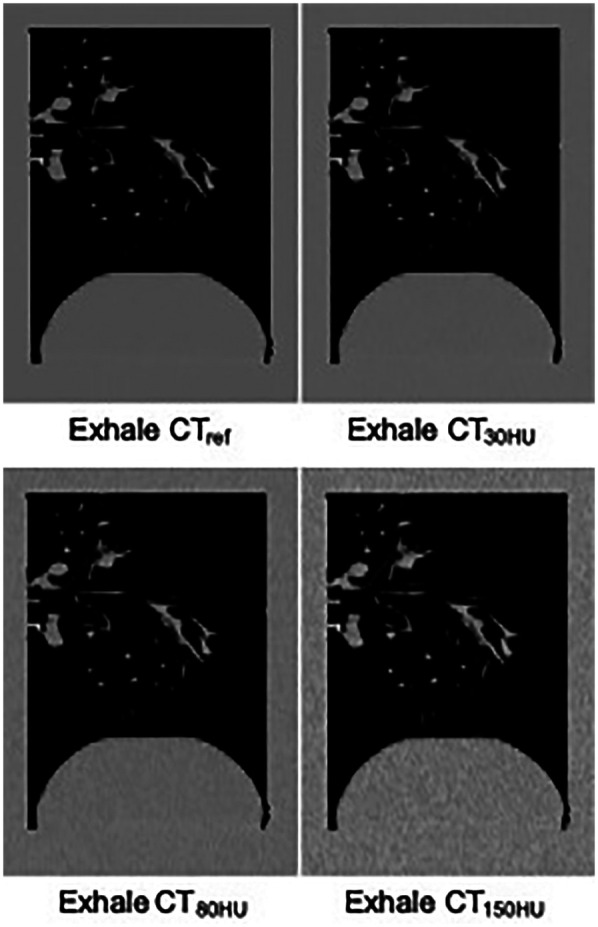 Assessing the consistency of CT-based ventilation imaging under noise reduction processing with simulated quantum noise using a nonrigid alveoli phantom.