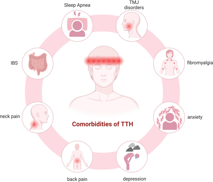 Hallmarks of primary headache: part 2- Tension-type headache.