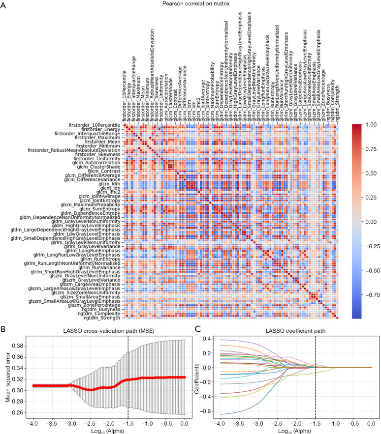 Integrating multimodal ultrasound imaging for improved radiomics sentinel lymph node assessment in breast cancer.