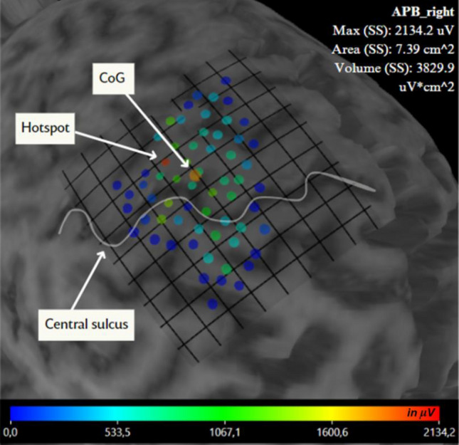 On the Relation Between the Interstimulus Intervals and Multi-Muscle nTMS Motor Mapping.