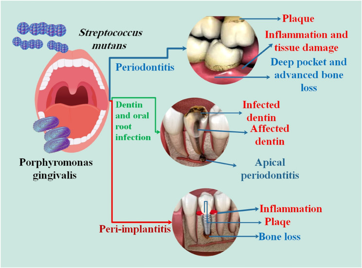 The Role of Nrf2 in the Regulation of Periodontitis, Peri-implantitis, Dentin Infection, and Apical Periodontitis.