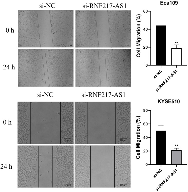 Regulatory Role and Mechanism of lncRNA RNF217-AS1 in the Proliferation and Migration of Esophageal Cancer Cells.