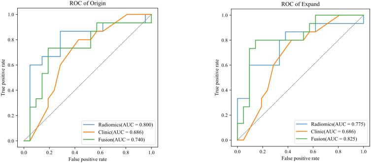 Can Peritumoral Radiomics Based on MRI Predict the Microvascular Invasion Status of Combined Hepatocellular Carcinoma and Cholangiocarcinoma Before Surgery?