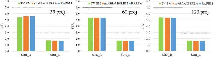 Hyperparameter-controlled regularized reconstruction method based on object structure and acquisition conditions in SPECT.