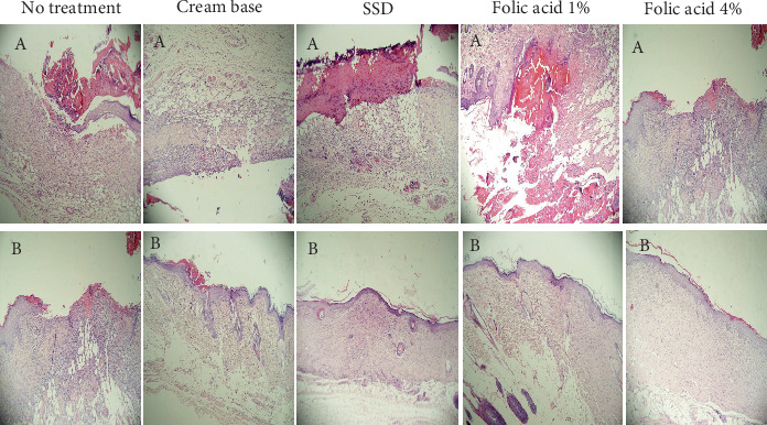 Efficacy of Topical Folic Acid in the Healing of Deep Second-Degree Burn Wound via Redox Modulation in Rat.