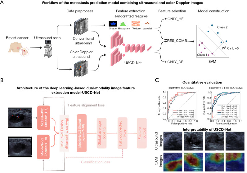 Integrating multimodal ultrasound imaging for improved radiomics sentinel lymph node assessment in breast cancer.