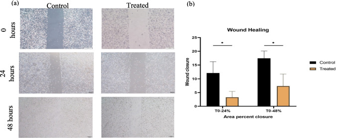 Evaluation of the impact of Roclaglamide on MDA-MB-231 human breast adenocarcinoma cells by cell culture and molecular approaches.