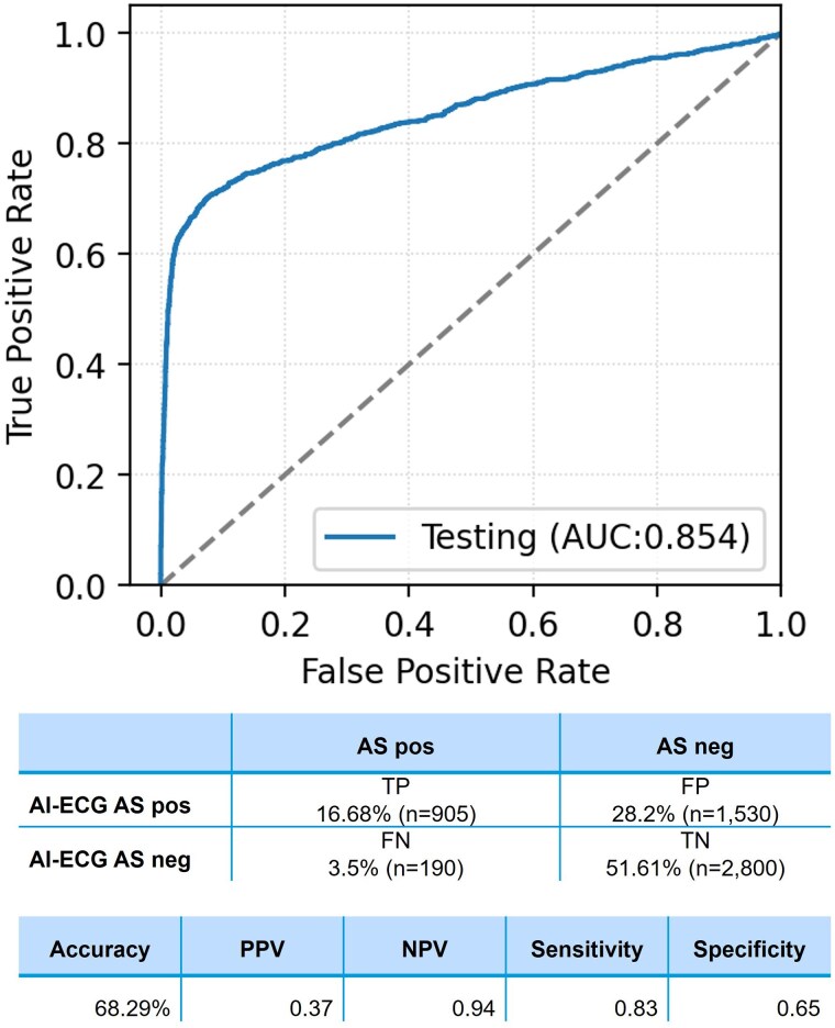 External assessment of an artificial intelligence-enabled electrocardiogram for aortic stenosis detection.
