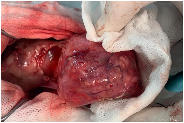 Mediastinal eosinophilic sclerosing fibroplasia associated with <i>Staphylococcus aureus</i> infection in a cat.