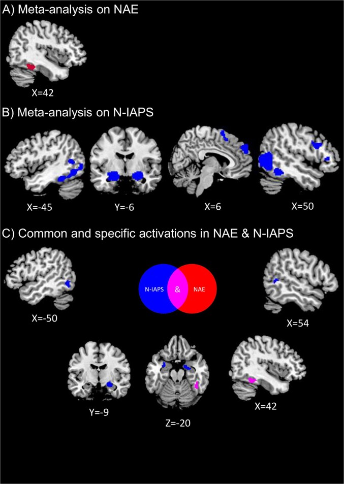 Neural correlates of negative aesthetic evaluations in visual art: a neuroimaging meta-analysis.