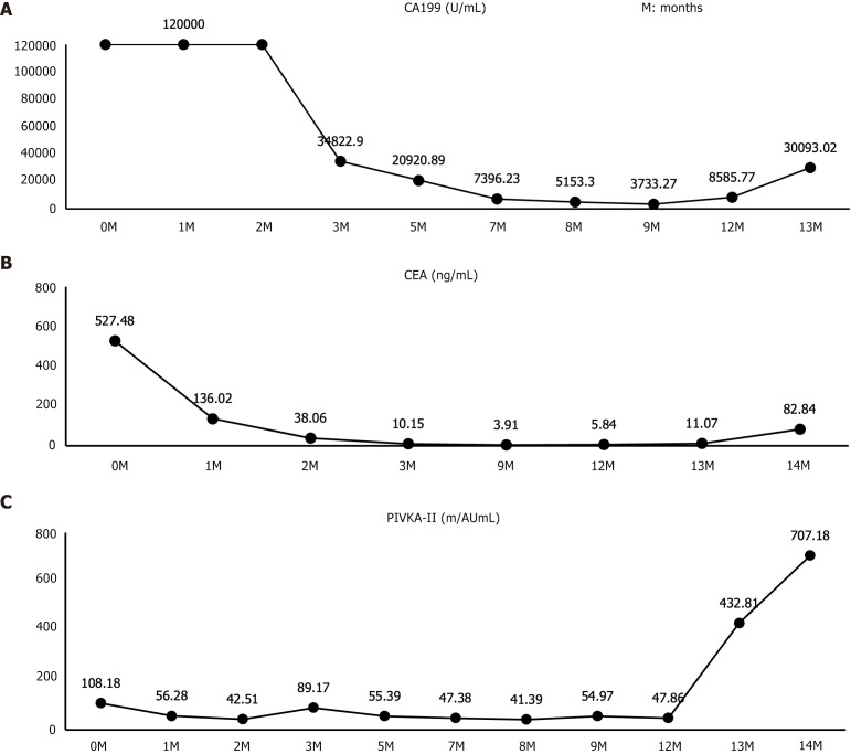 Molecular tumor boards in pancreatic cancer with liver metastasis: A case report.