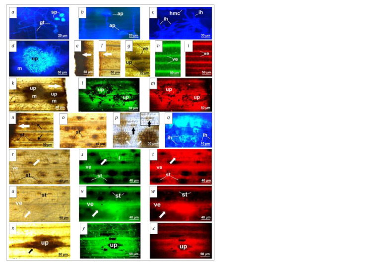 Cytophysiological manifestations of wheat's defense reactions against stem rust induced by the biofungicide Novochizol.