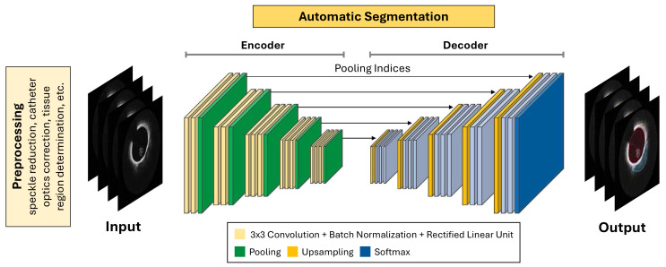 Artificial Intelligence-based Approaches for Characterizing Plaque Components From Intravascular Optical Coherence Tomography Imaging: Integration Into Clinical Decision Support Systems.