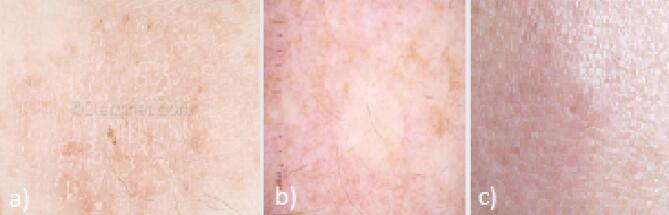 Classification of skin diseases with deep learning based approaches.