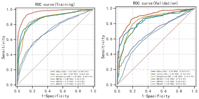 Interpretable XGBoost model identifies idiopathic central precocious puberty in girls using four clinical and imaging features.