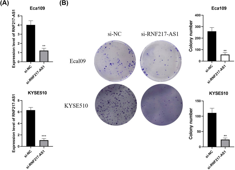 Regulatory Role and Mechanism of lncRNA RNF217-AS1 in the Proliferation and Migration of Esophageal Cancer Cells.