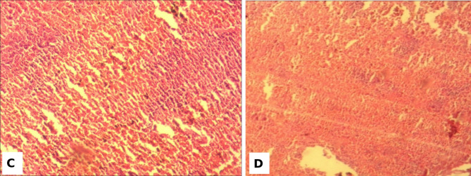 Preclinic evaluation of the safety of potential anticovid-19 phytomedicine: SAYE PLUS impacts on Wistar rat biochemical and histopathological parameters in sub-chronic toxicity study.