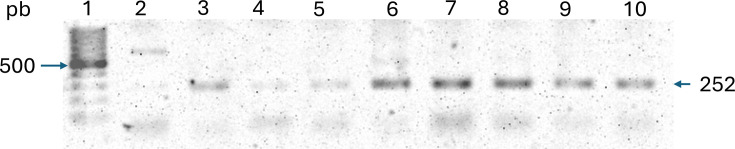 Incidence rates of resistant enterotoxigenic Escherichia coli in fresh vegetables and salads.