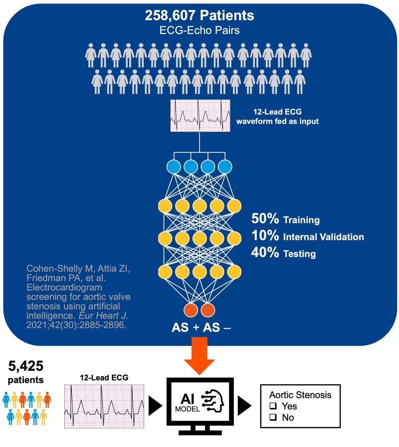 External assessment of an artificial intelligence-enabled electrocardiogram for aortic stenosis detection.