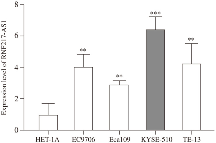 Regulatory Role and Mechanism of lncRNA RNF217-AS1 in the Proliferation and Migration of Esophageal Cancer Cells.