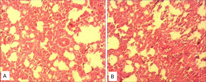 Preclinic evaluation of the safety of potential anticovid-19 phytomedicine: SAYE PLUS impacts on Wistar rat biochemical and histopathological parameters in sub-chronic toxicity study.