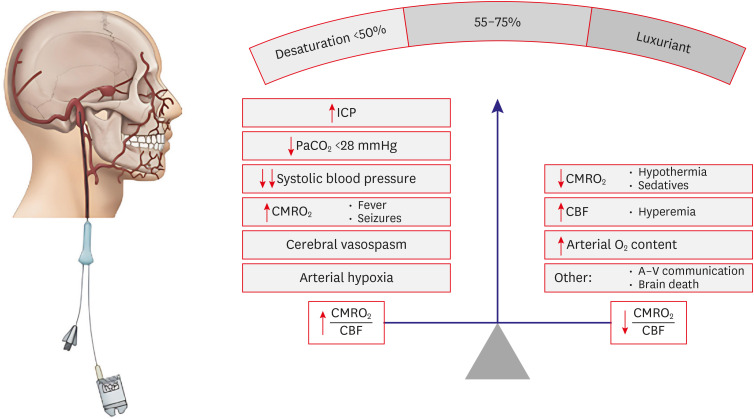 Brain Oxygenation and Metabolism Monitoring in Acute Brain Injury: Review on Current Trends and Clinical Implications.