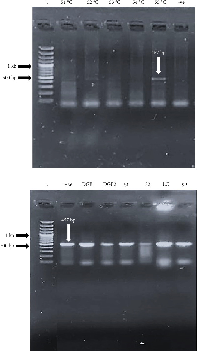 Evaluating the Drinking Water Distribution System of Lahore for Free-Living Amoebas, Particularly <i>Naegleria</i> spp.