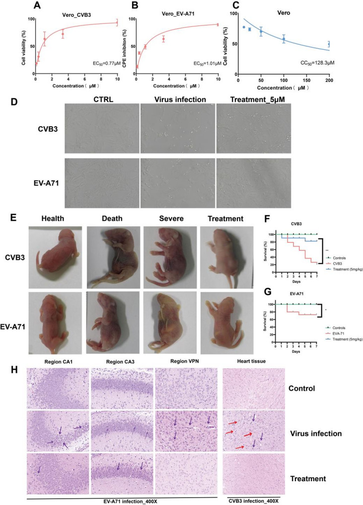 Mechanism research of Punicalagin in treating representative strains of enterovirus A and B types based on systems pharmacology and experimental validation.