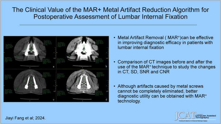The Clinical Value of the MAR + Metal Artifact Reduction Algorithm for Postoperative Assessment of Lumbar Internal Fixation.