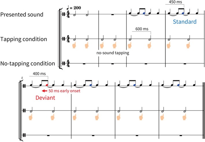 Active Inference in Music Perception: Motor Engagement to Syncopation Modulates Rhythmic Prediction Error.
