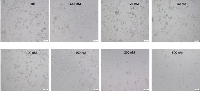 Evaluation of the impact of Roclaglamide on MDA-MB-231 human breast adenocarcinoma cells by cell culture and molecular approaches.
